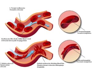 hemoglobin increase food in tamil