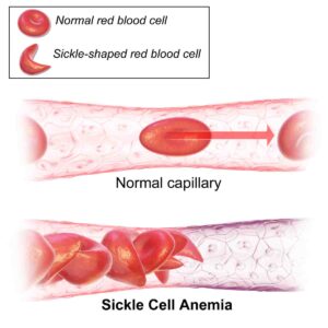 hemoglobin rich foods in tamil