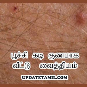 poochi kadi symptoms in tamil